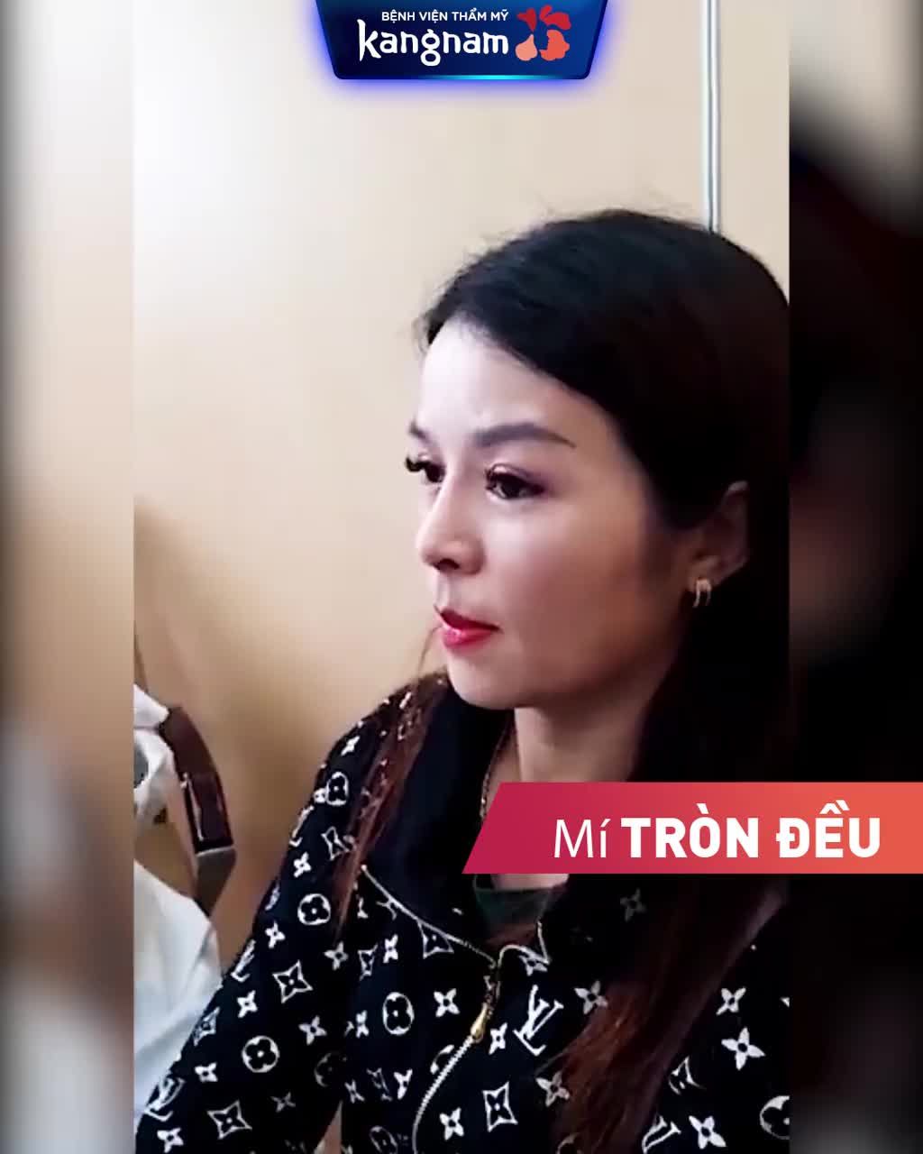 Năm mới - Diện mạo mới Lột Xác với NÂNG MŨI + CẮT MÍ