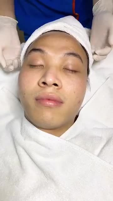 Da xinh ĐÓN TẾT - Kết quả TRỊ MỤN mỹ mãn sau 8 buổi