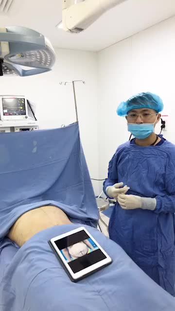 Kết quả khách hút mỡ Slim Lipo tạo hình thành bụng + Lipo đùi sau 60 ở thực hiện đã có được vóc dáng mong muốn