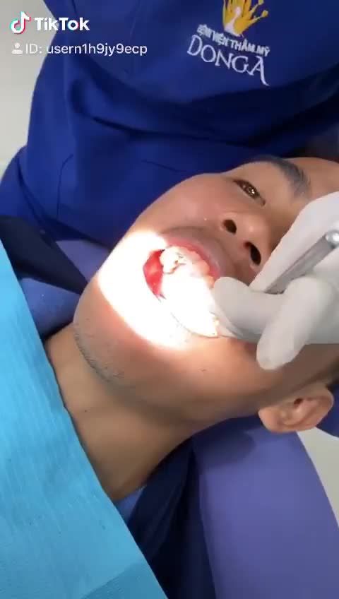 Cận cảnh quá trình trám răng cho khách hàng tại bệnh viện thẩm mỹ Đông Á Chuẩn bị răng chắc khỏe để đón Tết thôi nào