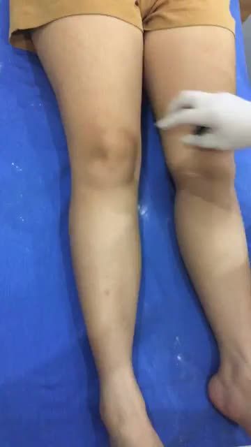 Triệt lông chân bằng công nghệ Diode Laser . Đánh bay sạch lông chỉ sau 1 liệu trình .