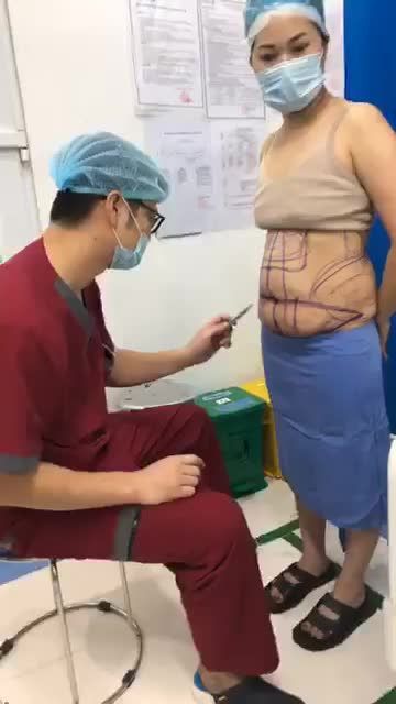 Vòng 2: Mỡ thừa chảy xệ  Da chùng nhão  Rạn da