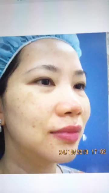 Chăm sóc da bằng công nghệ Vital Skin mang đến làn da trắng sáng, căng bóng .