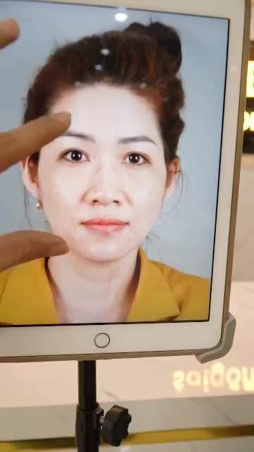 GẶP LẠI KHÁCH HÀNG SAU 7 NGÀY NÂNG MŨI