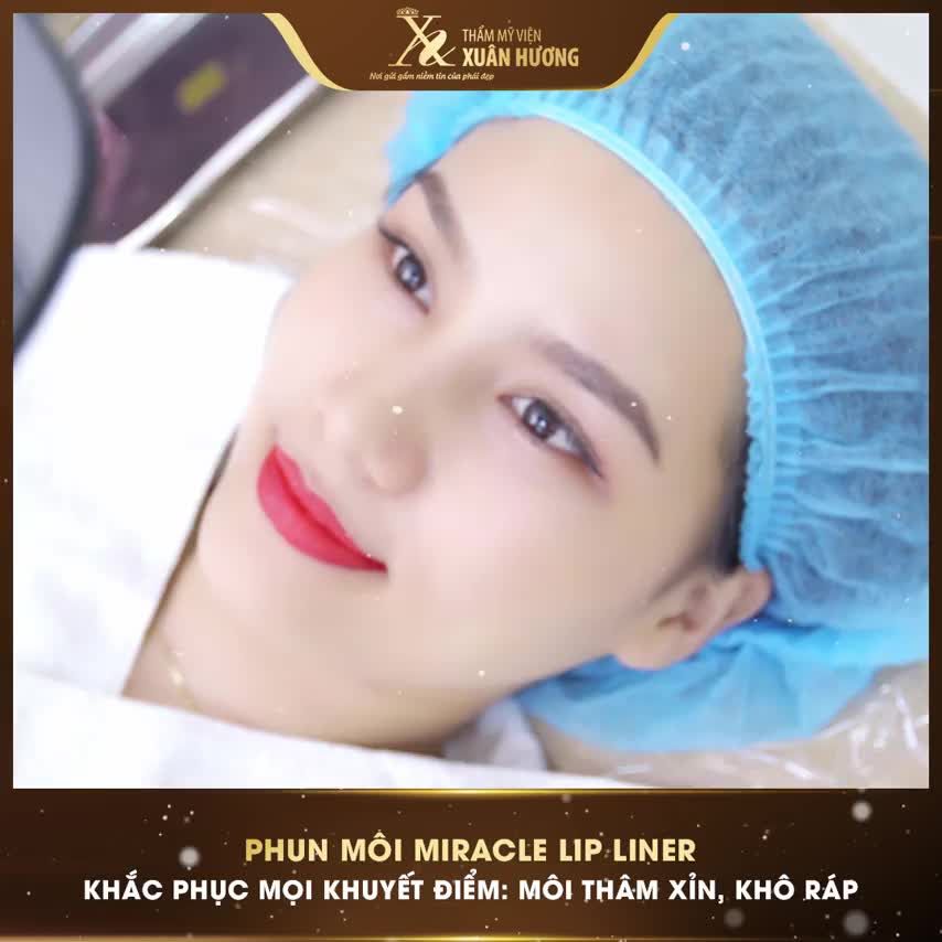 TỰ TI VÌ MÔI THÂM ĐẾN NỖI ĐỂ SON NGAY CẢ KHI NGỦ, CHỊ KHÁCH HÀNG QUYẾT ĐỊNH ĐI PHUN MÔI NHANH CÒN KỊP ĐẸP ĐÓN TẾT