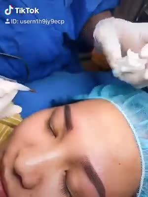 Cận cảnh quá trình phun xăm lông mày tại bệnh viện thẩm mỹ Đông Á