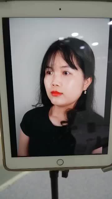 MŨI ĐẸP MỸ MÃN SAU 45P NÂNG MŨI CẤU TRÚC TẠI DR.HOẠT