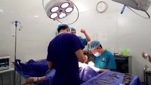 Ca mũi siêu lỗi của khách hàng nâng mũi tại spa bị biến dạng đến gặp Bsi Quang để giải cứu