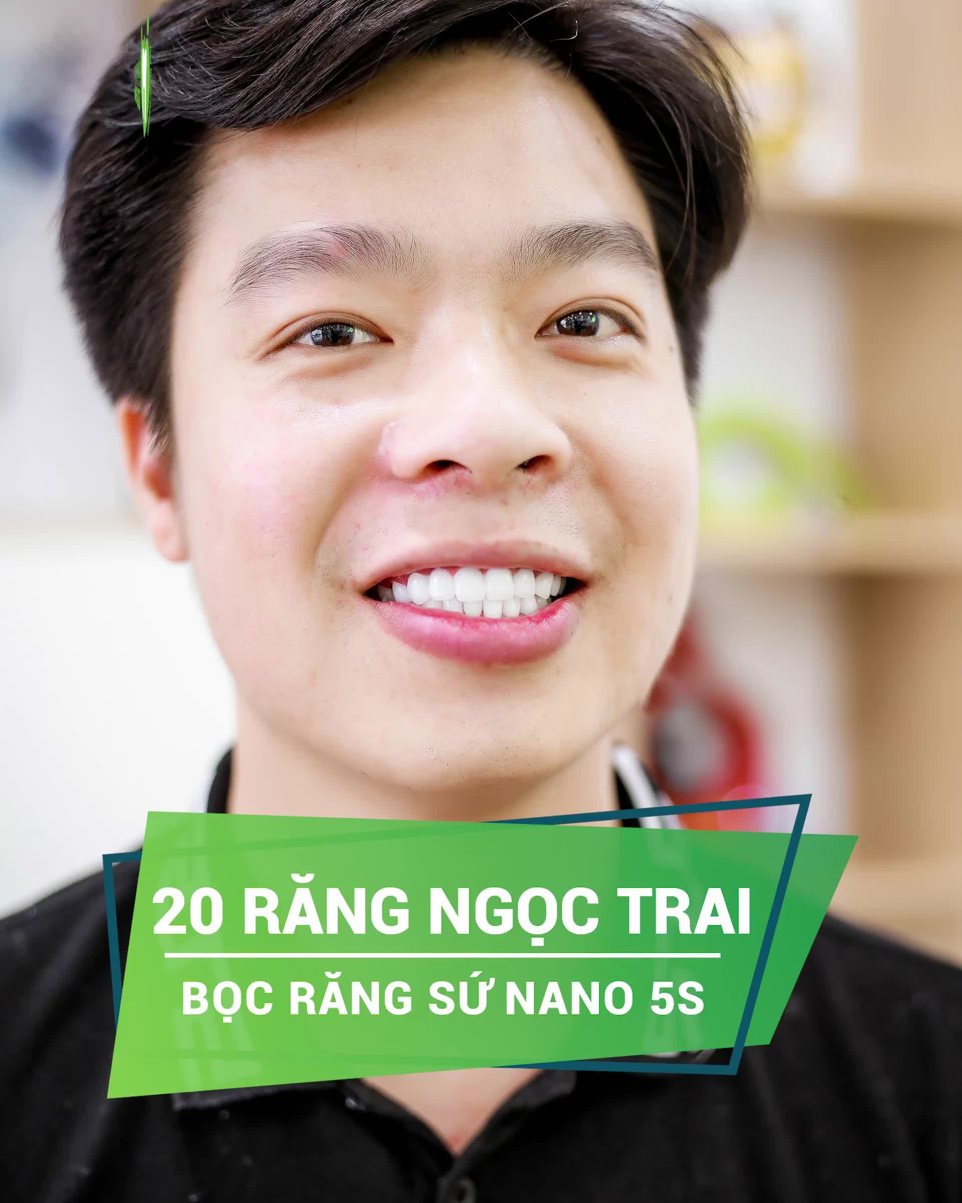THẨM MỸ 20 RĂNG NGỌC TRAI CAO CẤP – ĐẸP RẠNG NGỜI VỜI NỤ CƯỜI MỚI