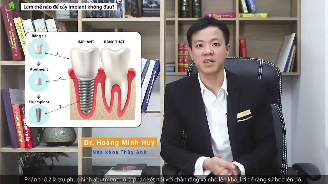 LÀM SAO ĐỂ TRỒNG RĂNG IMPLANT KHÔNG ĐAU