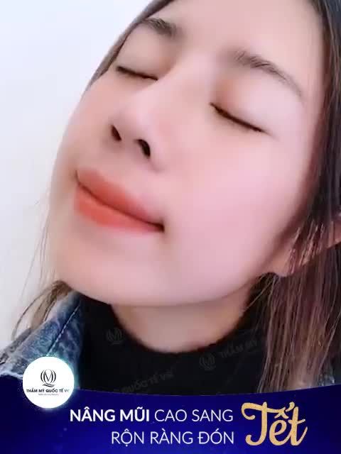 MŨI SIÊU ĐẸP KHÔNG LO VỀ GIÁ