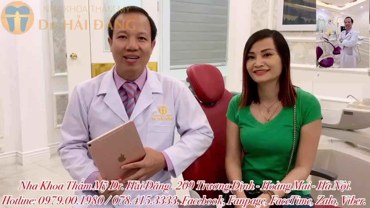 Thẩm mỹ 17 răng sứ cao cấp. Nụ cười hoàn hảo thay đổi sau 24h.