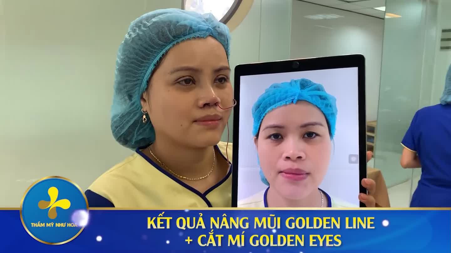 Thêm 1 khách hàng chọn F5 nhan sắc đón Tết với combo Nâng mũi - Cắt mí tại Dr.Tống Hải.