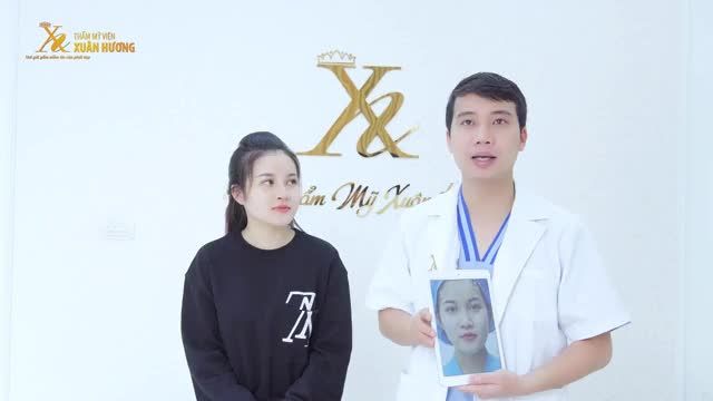 "BẠN BÈ EM CÒN KHÔNG TIN LÀ VỪA MỚI NÂNG MŨI ĐƯỢC MẤY NGÀY. QUÁ NHANH LÀNH!"