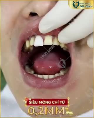 NỤ CƯỜI RẠNG NGỜI – MỪNG ĐÓN XUÂN SANG