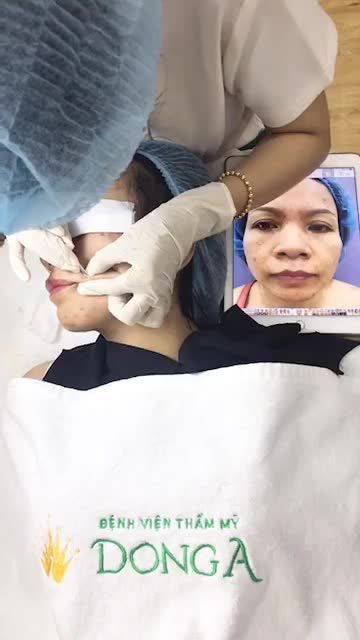 ACNE REMOVE TRỊ MỤN CHUYÊN SÂU - SẠCH MỌI LOẠI MỤN NANG/ VIÊM/ ĐẦU ĐEN