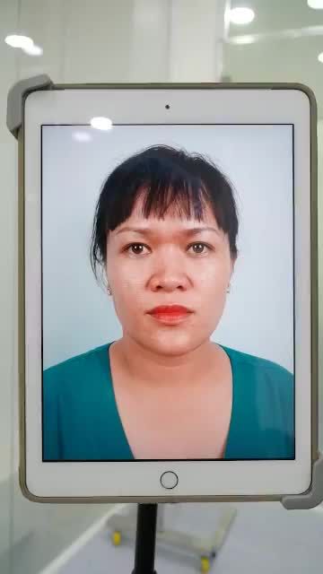 CÀNG GẦN ĐẾN TẾT NÂNG MŨI CẤU TRÚC TẠI DR.HOẠT LẠI CÀNG HOT