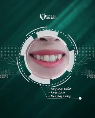 LÀM ĐẸP NỤ CƯỜI – XINH TƯƠI ĐÓN TẾT