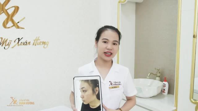 TRỊ TÀN NHANG 1 LẦN SẠCH ĐẾN 95% - THOẢI MÁI ĐẸP KỊP TẾT VỚI CÔNG NGHỆ NEW PASTELLE TẠI TMV XUÂN HƯƠNG