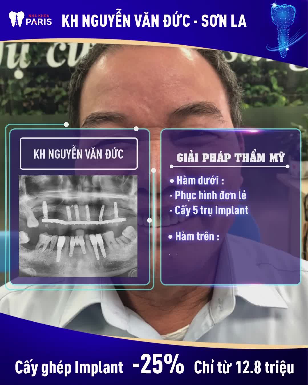 MẤT NHIỀU RĂNG 2 HÀM - KHÔI PHỤC ĐƯỢC KHÔNG?