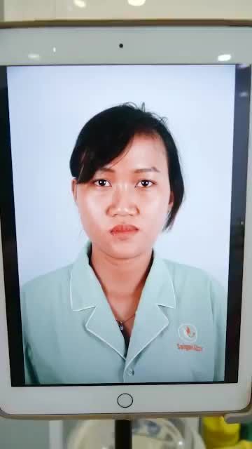 DÁNG MŨI CẤU TRÚC VỪA ĐƯỢC DR.HOẠT THỰC HIỆN XONG