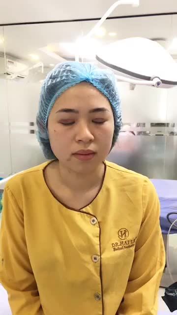 Đôi mắt hai nếp mí không tự nhiên khiến gương mặt chị khách hàng lúc nào cũng mệt mỏi, u sầu, thiếu sức sống.