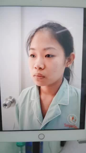 NÂNG MŨI CẤU TRÚC ĐẸP MỸ MÃN NGAY SAU THỰC HIỆN
