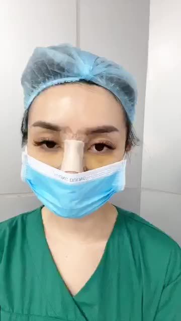 Ca bụng số 1 hôm nay - Ca bụng số 7 năm 2020