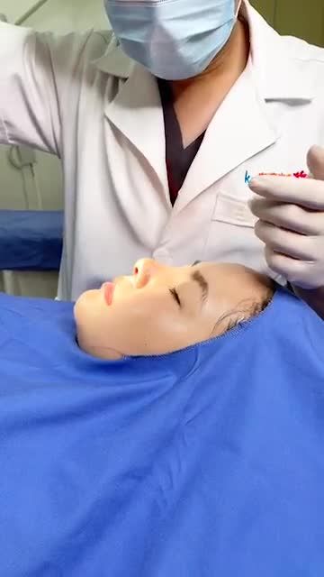 SAU 10 NGÀY Cắt chỉ sau nâng mũi - Mũi cao thanh tú - Đẹp mọi góc nhìn