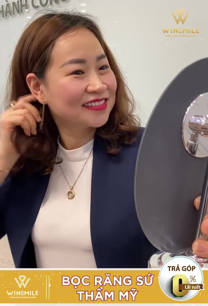 Khách hàng: Vũ Thị Hằng Nga Tình trạng răng: răng thưa, không đều, 2 răng cửa hàm trên bị vếch sang 2 bên
