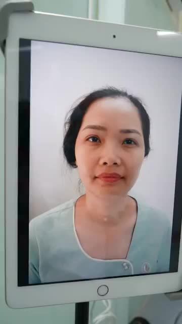 MŨI CẤU TRÚC VỪA THỰC HIỆN XONG