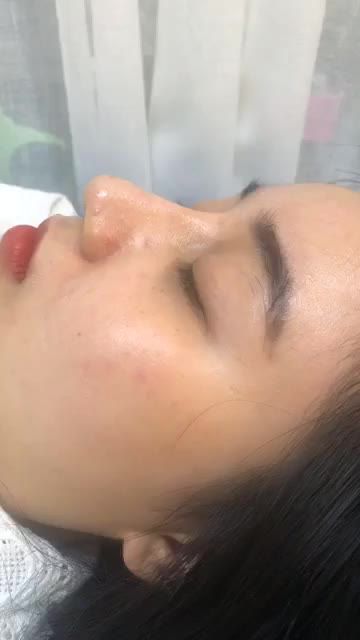 Mũi xênh chohotgirl nhà Bác Sĩ KỲ Y Dược