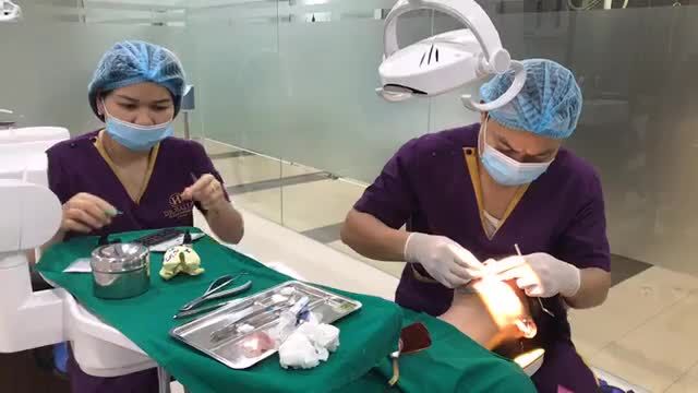 Cận cảnh case Niềng răng mắc cài sứ cho bạn nam