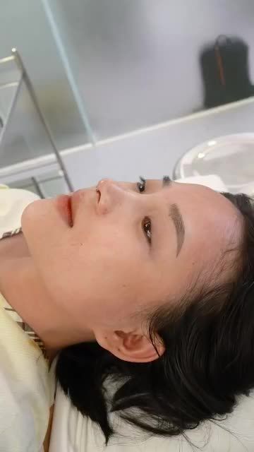 NÂNG MŨI CẤU TRÚC RẠNG NGỜI ĐÓN TẾT