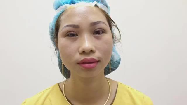 Tưởng không đẹp mà ĐẸP KHÔNG TƯỞNG với cắt mí Mani Mini Deep - Khắc phục tình trạng nếp mí nhỏ, mí sụp, mang lại đôi mắt tươi trẻ, rạng ngời