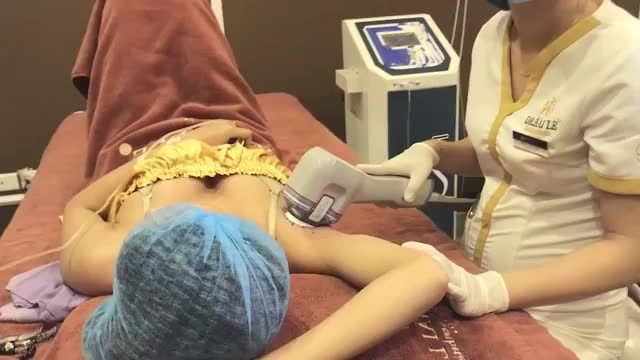 CÙNG XEM QUY TRÌNH ĐIỀU TRỊ CHỨNG TĂNG TIẾT MỒ HÔI NÁCH DOUBLE MIRADRY