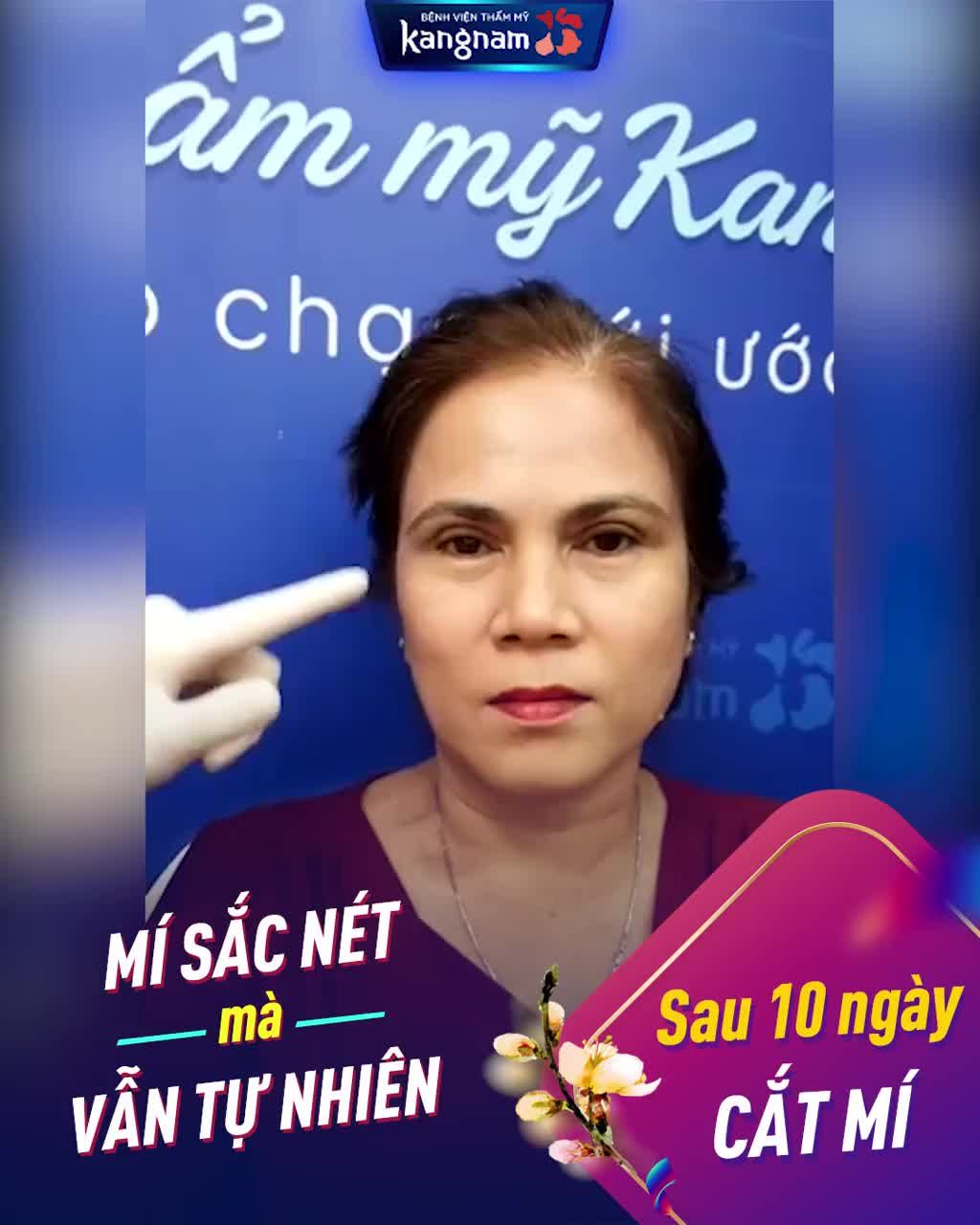 "Giải cứu" MẮT LÃO HÓA Trẻ ra 10 TUỔI nhờ Hết Da Chùng