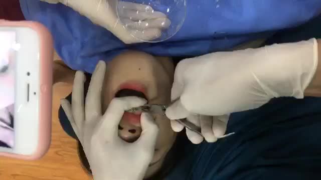 Tháo mắc cài cho banh thuý hằng
