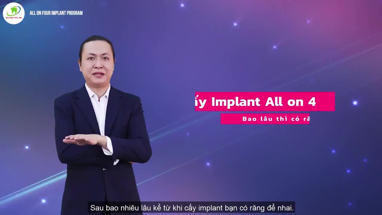 CẤY IMPLANT NGUYÊN HÀM ALL ON 4 BAO NHIÊU LÂU BẠN ĐƯỢC LẮP RĂNG