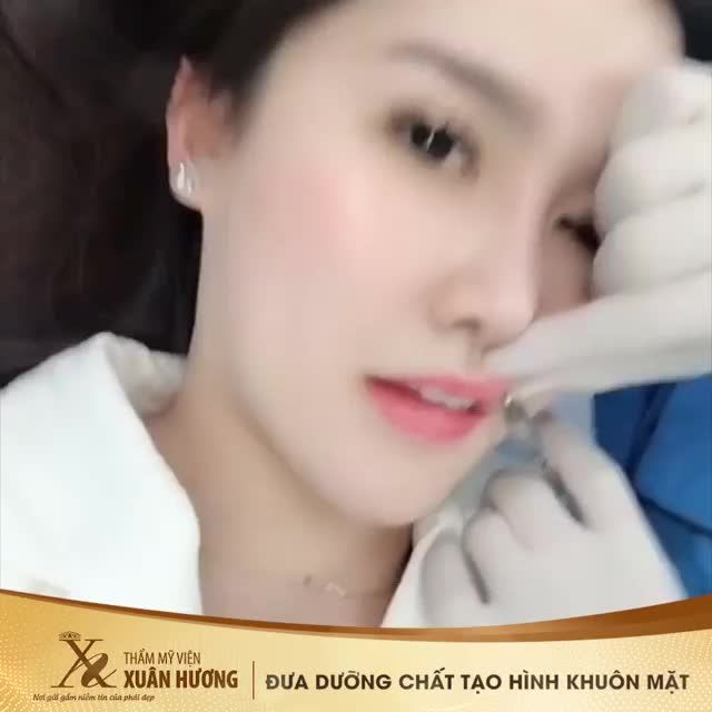 ĐƯA DƯỠNG CHẤT TẠO HÌNH KHUÔN MẶT- XINH RẠNG NGỜI DU XUÂN NHẬN LỘC ĐẦU NĂM