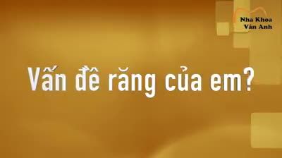 Trước đây em bị thưa 4 răng cửa. Và nó làm em mất tự tin khi giao tiếp cũng như trong sinh hoạt. Em cảm thấy khi nói chuyện hay khi cười thì không được tự nhiên.