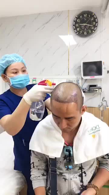 Thay băng tóc ngày thứ 2 sau khi cấy tóc tại Bệnh viện thẫm Mỹ Đông Á