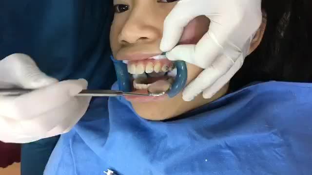 Gắn mắc cài cho bạn Thu Phương