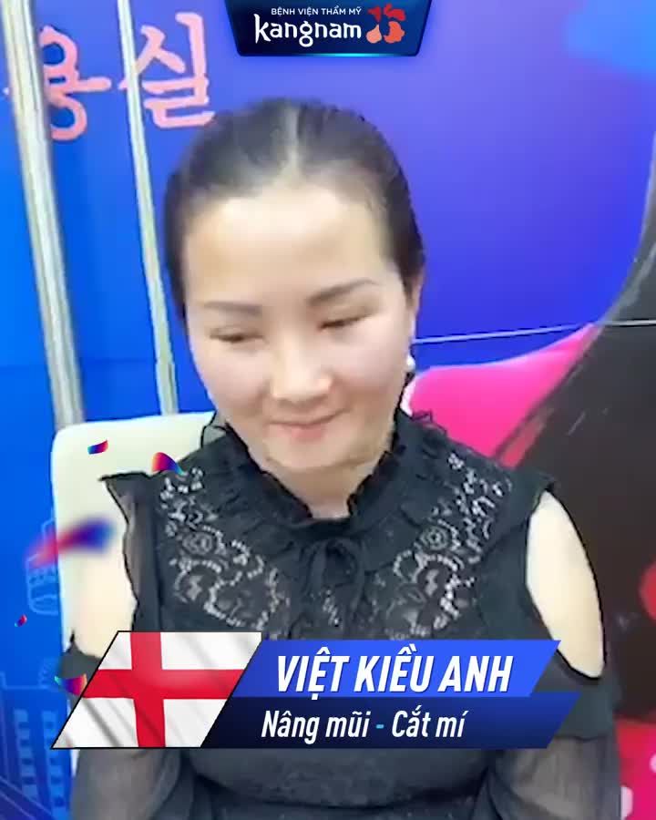Chỉ NÂNG MŨI + CẮT MÍ Không còn nhận ra mình trong gương
