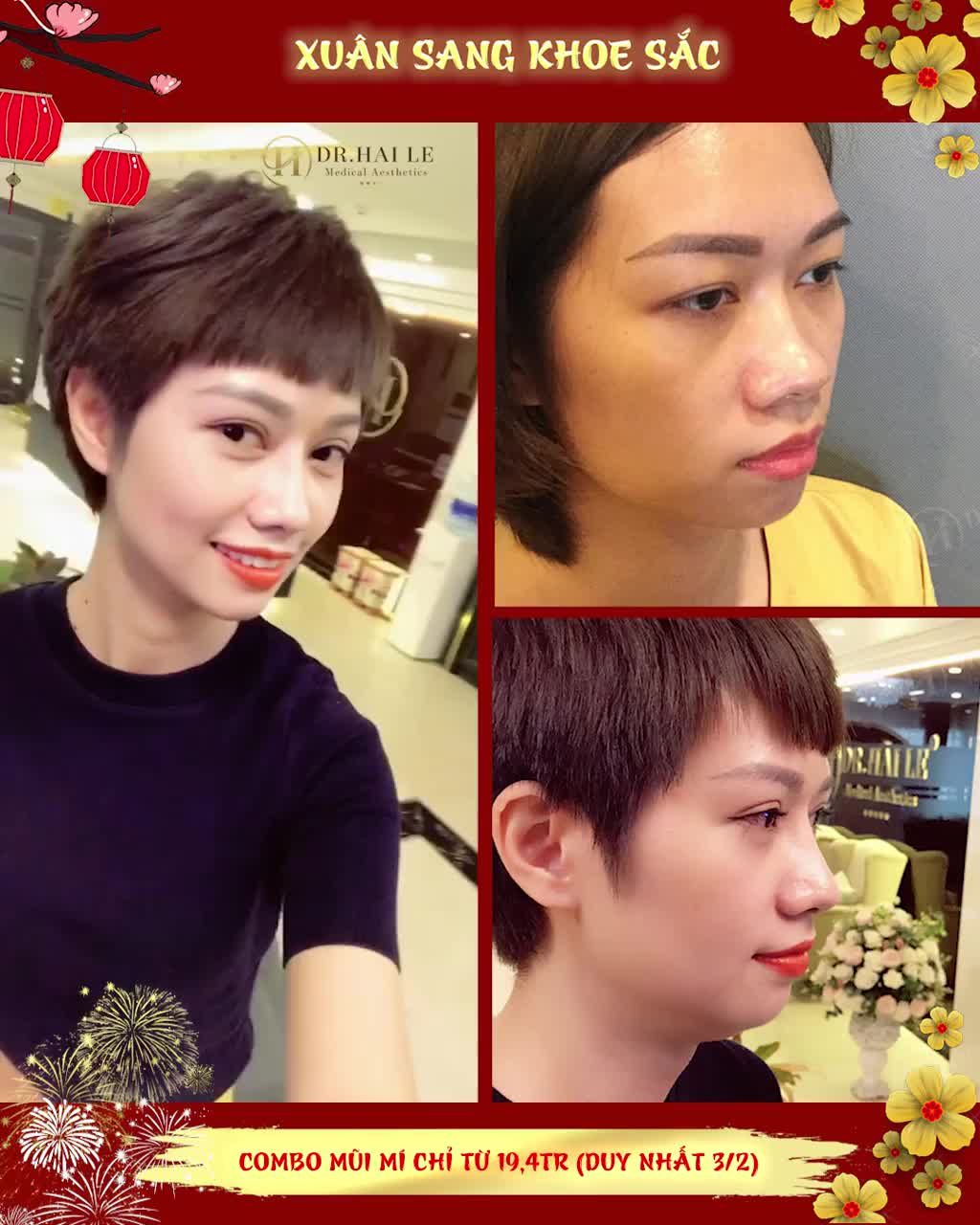 Combo "lột xác" thần thánh tại Dr. Hải Lê.!