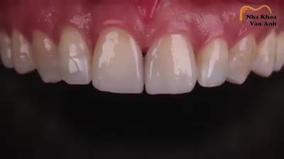 Nụ cười đẹp - lôi cuốn giúp bạn nhiều cơ hội giao tiếp sự nghiệp thăng hoa