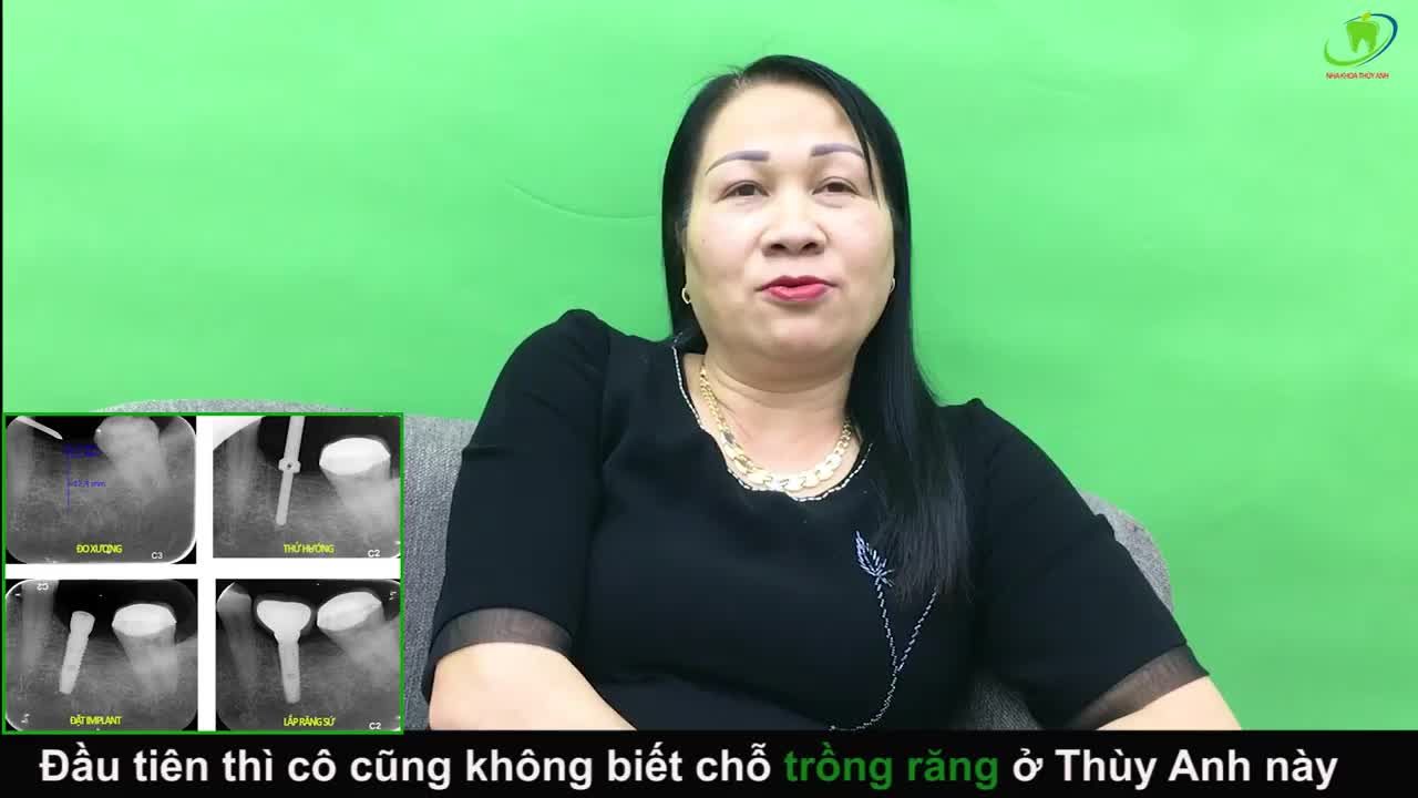 SỞ HỮU HÀM RĂNG CHẮC KHỎE TỰ TIN ĐÓN TẾT BẰNG PHƯƠNG PHÁP CẤY CHÂN RĂNG NHÂN TẠO IMPLANT TẠI NHA KHOA THÙY ANH