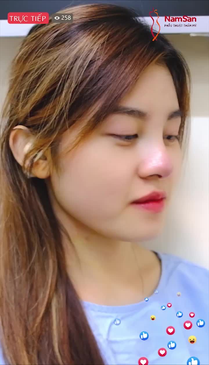 TRƯỚC TẾT NÊN LÀM: NÂNG MŨI TƯỚNG SỐ – THAY ĐỔI VẬN MỆNH – MAY MẮN DỒI DÀO.