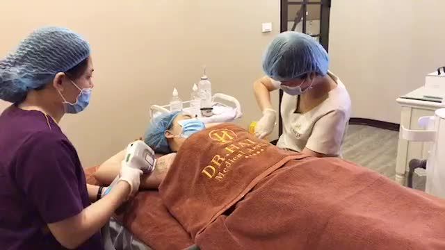 Trị hôi nách và tăng tiết mồ hôi bằng công nghê Double MiraDry.