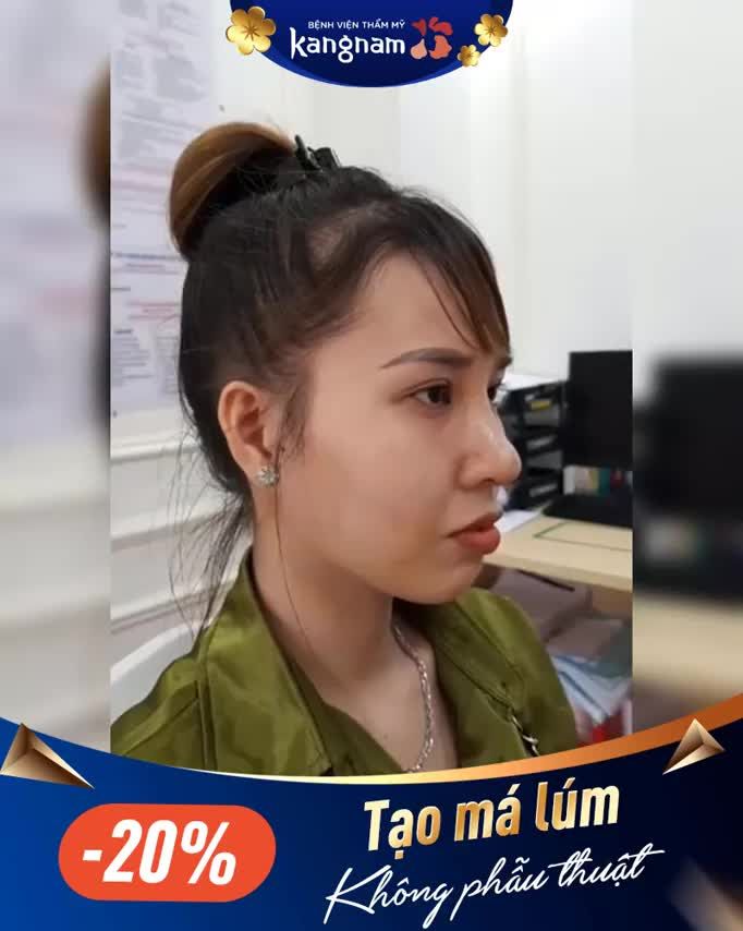 Xem ngay kết quả TẠO MÁ LÚM sau 10 Ngày
